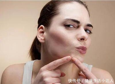 下巴长痘痘与妇科有关系吗
