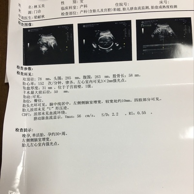 怀孕30周真实胎儿图片