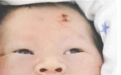 孕11周是几个月
