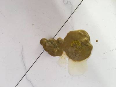 六个月宝宝正常大便图片