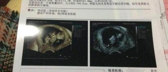 胎儿6个月发育情况