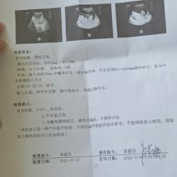 三个月能打胎吗
