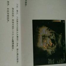 胎儿14周会有胎动吗