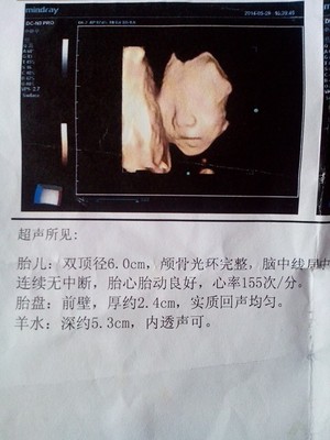 怀孕6个多月胎动少正常吗