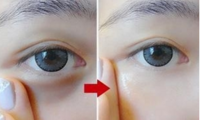 眼部肿胀
