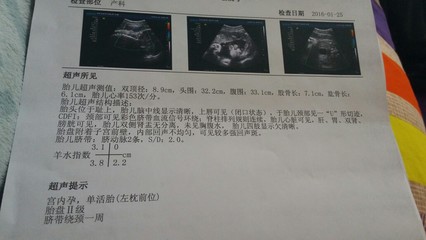 怀孕了怎么看男女