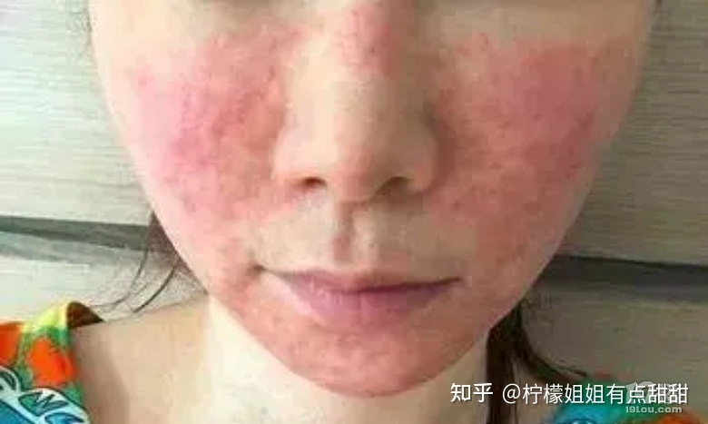 打水光疼吗