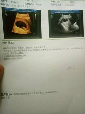 怀孕8周胎儿图片欣赏