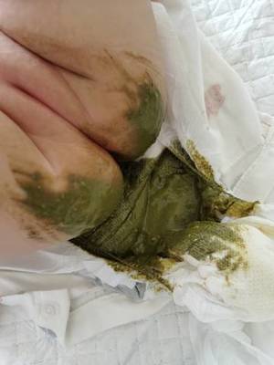 六个月宝宝正常大便图片