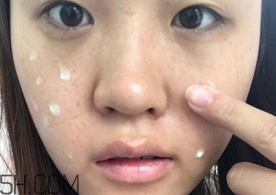 痘印可以自己淡化吗