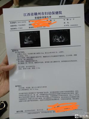 江西省妇幼保健院彩超多少钱