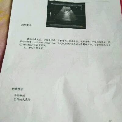 宫颈囊肿可以怀孕吗