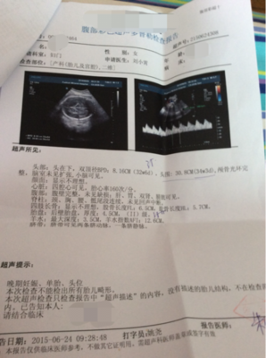 孕35周几个月