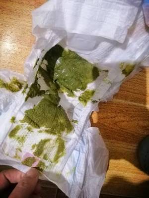大便墨绿色是怎么回事