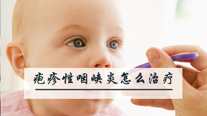 囗腔疱疹怎么治疗