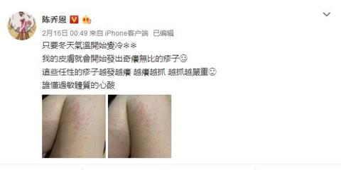 怀孕容易流鼻血吗