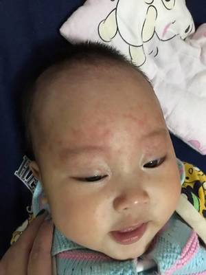 五个月宝宝多少度算发烧
