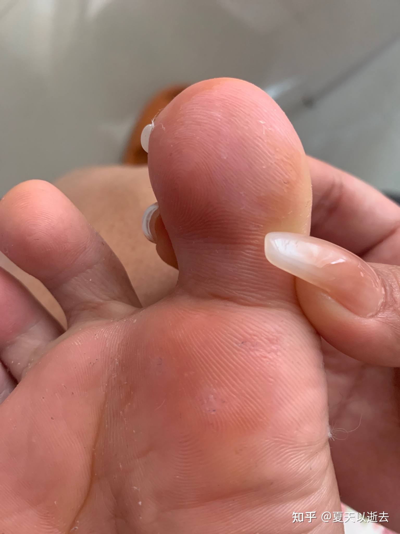 脚麻麻的是怎么回事