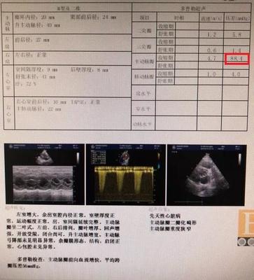 做dr后多久可以怀孕