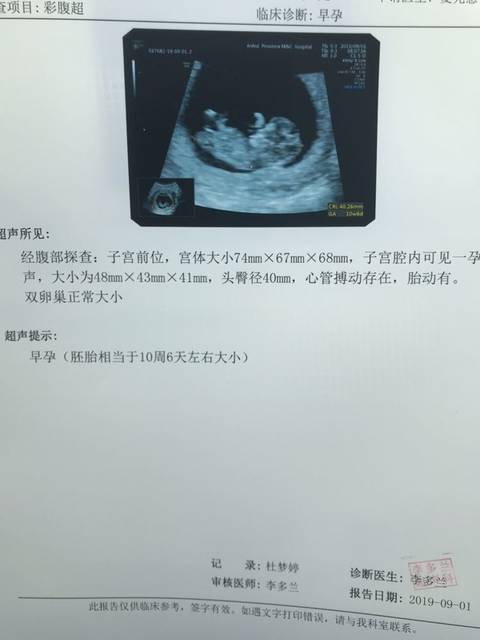怀孕10周图片