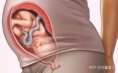 怀孕28周腰酸会早产