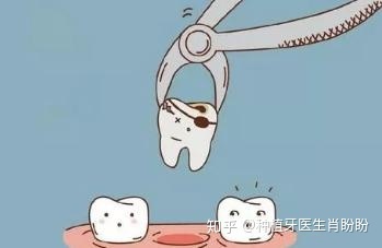 智齿拔牙疼吗