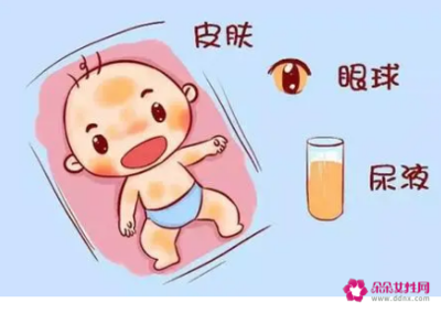 新生儿肠道出血