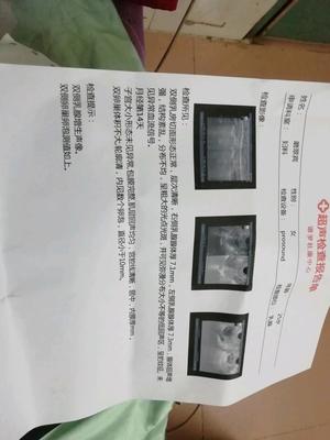 卵泡长不大会怀孕吗