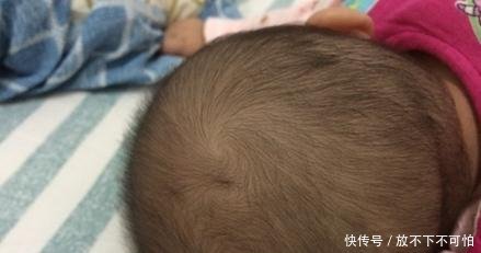 宝宝头顶旋偏右说法