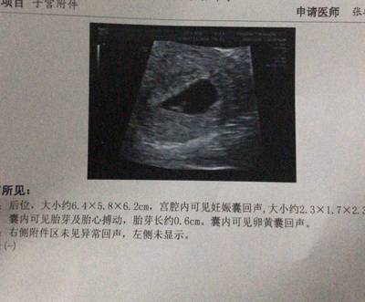 怀孕6周是多少天了