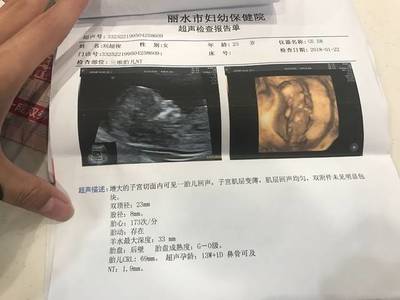 怀孕三个月见红了怎么办