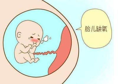 如何知道胎儿是否缺氧