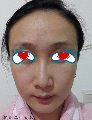 慢跑能瘦脸吗