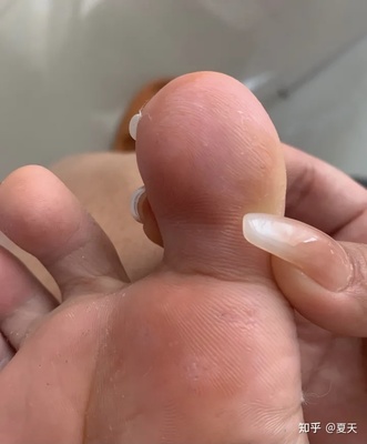 脚麻麻的是怎么回事