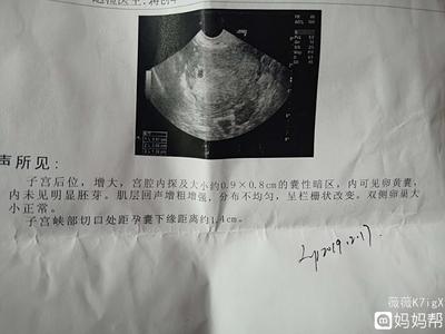 怀孕七周可以做人流吗
