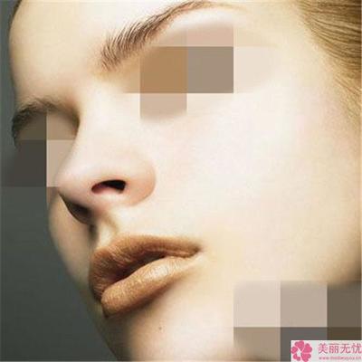 隆鼻后长了颗痘痘