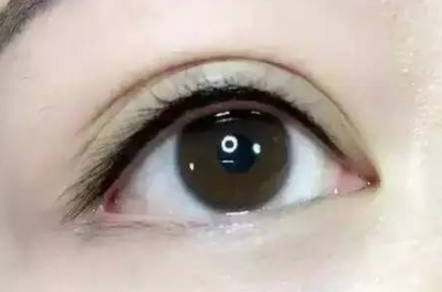 怀孕了能做双眼皮吗