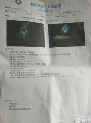 孕36周后胎儿一周一般能长重