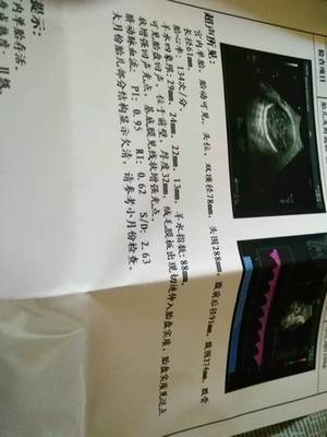胎儿后期一周长多少斤