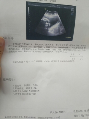 30周胎儿图片