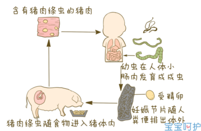 如何判断肚子里有蛔虫