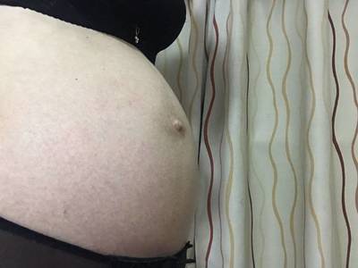 怀孕几个月开始长妊娠纹