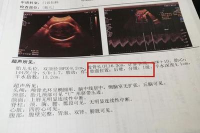 八个月胎儿发育情况对照表