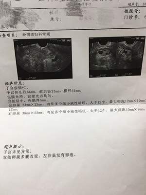 没有优势卵泡怎么治疗