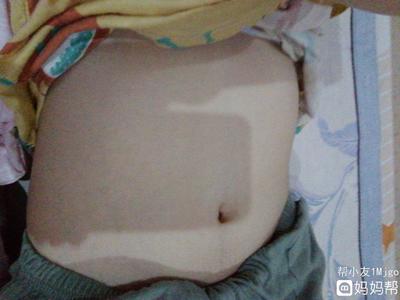 怀孕十一周有什么症状