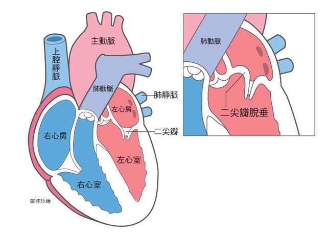 心房颤动怎么治疗