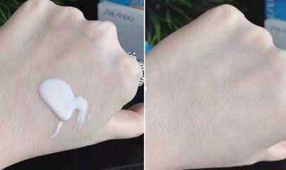 红奶白色痘痘