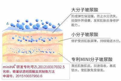 玻尿酸的区别