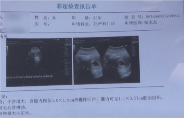 怀孕两天会恶心吗