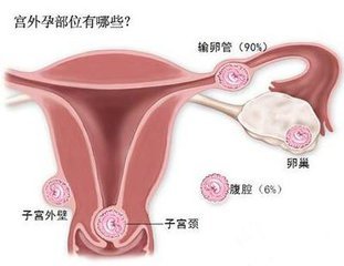 怀孕一个月大出血